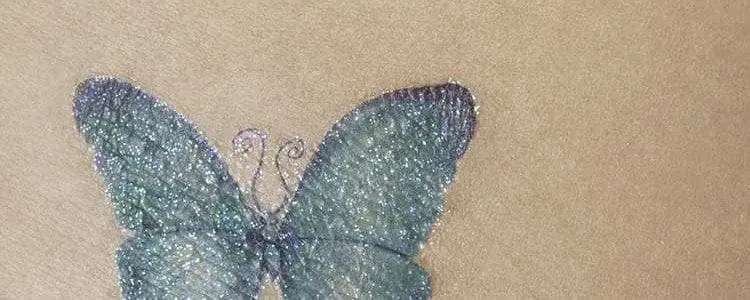 Tattoo Removal