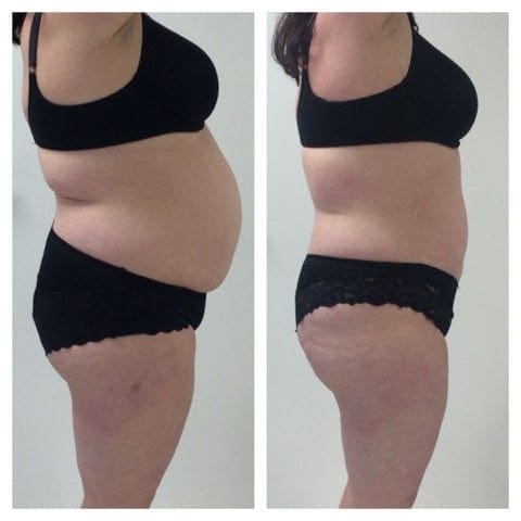 3D Lipo Example