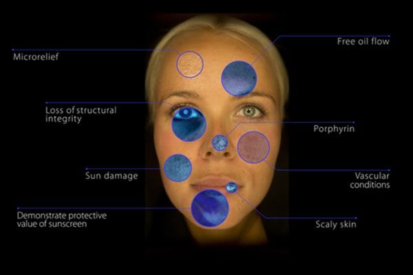 Computerised Skin Analysis