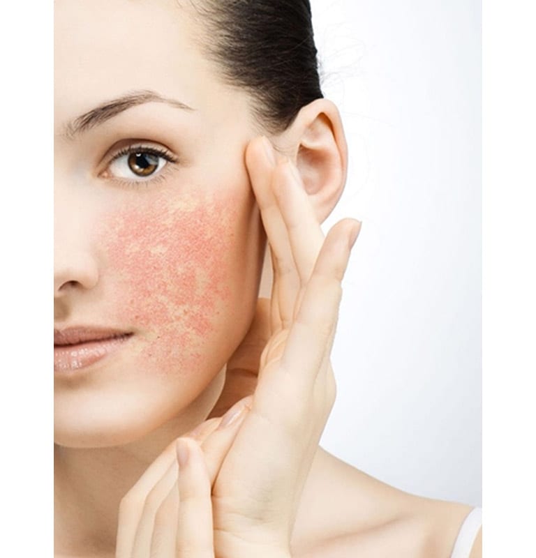 Is Your Skin Sensitive Or Sensitized The Banwell Clinic
